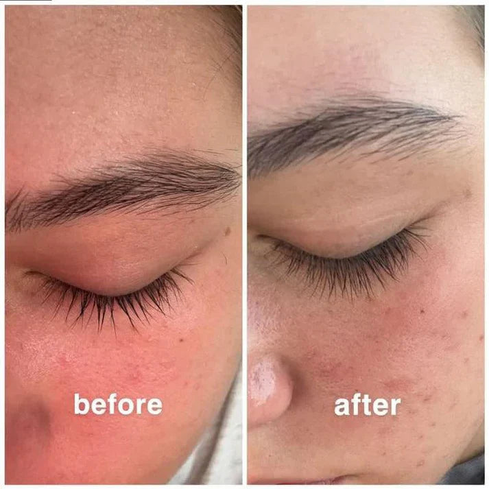 Loravi lash serum